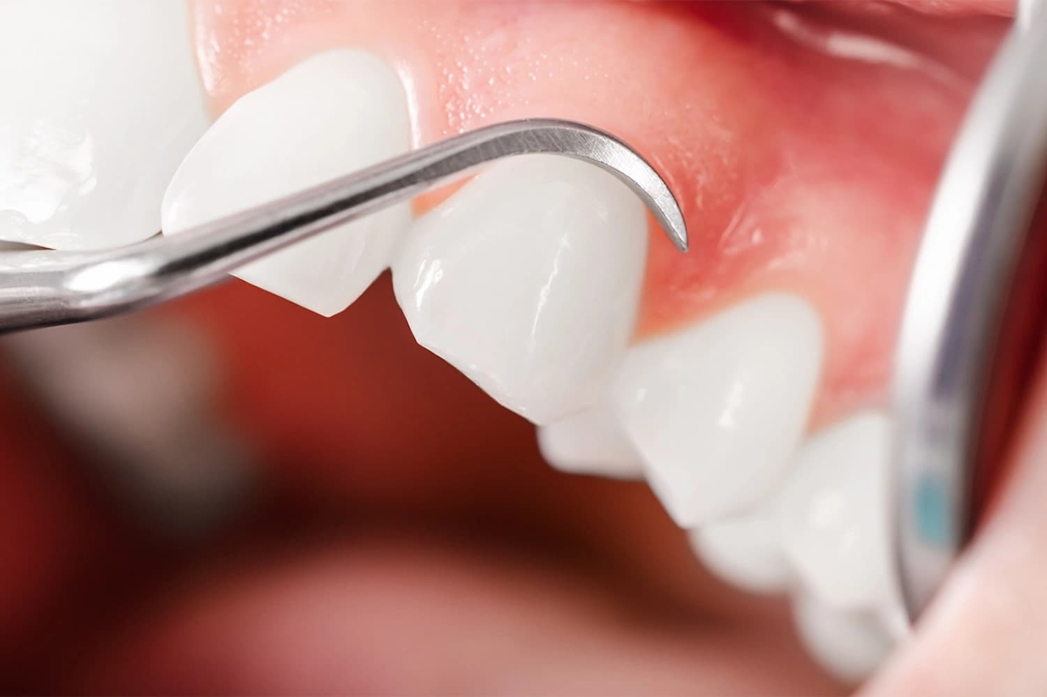 Periodontologia